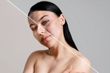 Cara Mudah Supaya Kulit Wajah Glowing, Cukup Rutin Konsumsi 3 Makan Ini