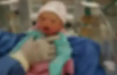 Dulu Bayi Ini Berisiko Mati Jika Disentuh, Namun Setelah 17 Bulan Usai Dirawat Beginilah Kondisinya