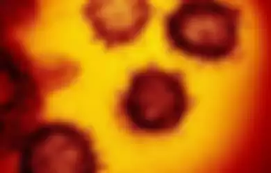 Gambar mikroskop elektron transmisi menunjukkan coronavirus baru yang muncul dari permukaan sel manusia.