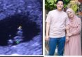 Usai Cut Meyriska Dinyatakan Positif Hamil, Roger Tak Sabar Menanti Kelahiran Hingga Bagikan Foto Pertama Calon Anaknya
