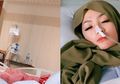 Sedih, Tubuh Imel Putri Digerogoti Kanker Sampai Rambutnya Botak, Janda Sirajuddin Mahmud Masih bisa Mengucap Syukur usai Teringat Hal Ini