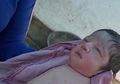 Meski Sangat Sehat Bahkan dari Dalam Kandungan, Bayi Perempuan Ini Lahir Tanpa Lengan dan Kaki hingga Membuat Petugas Medis Bingung, Kok Bisa?