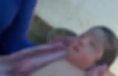 Meski Sangat Sehat Bahkan dari Dalam Kandungan, Bayi Perempuan Ini Lahir Tanpa Lengan dan Kaki hingga Membuat Petugas Medis Bingung, Kok Bisa?
