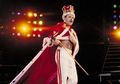 Freddie Mercury Meninggal Karena AIDS, Penting Tahu Cara Mencegahnya dengan Metode Ini