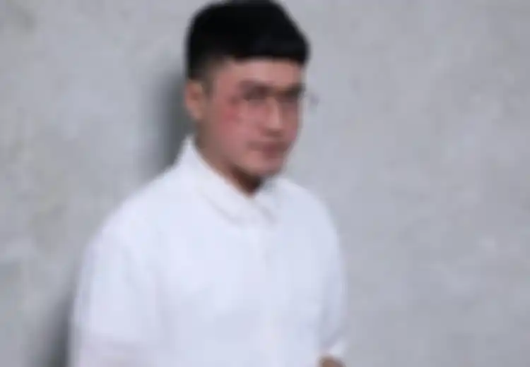 Desainer Barli Asmara Idap Penyakit Lambung sebelum Meninggal Dunia, Ternyata Inilah 3 Buah yang Dapat Mencegah Penyakit yang Sering Diabaikan Ini
