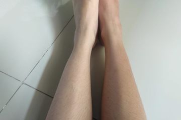5 Cara Mengatasi Kaki Pecah-Pecah Jadi Putih Kembali, Salah ...