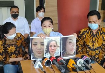 Bakal Buktikan Nindy Ayunda Punya Pria Idaman Lain, Pihak Askara Parasady Harsono Siap Boyong 6 Saksi