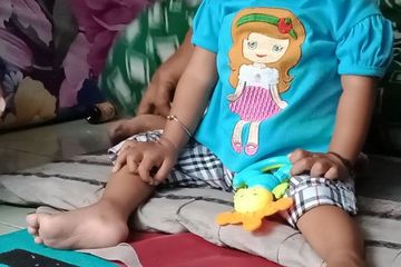 Kaleidoskop Penyakit 2022, Sudah Lama Dinyatakan Hilang dari Indonesia, Tiba-tiba Polio Muncul Lagi, Kasus Pertama di Aceh