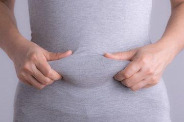 Perut buncit pada  orang kurus.
