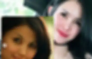  Cantik Tanpa Operasi, Foto Lawas Intan Hardja Beredar, Berbalik 180 Derajat, 3 Orang yang Lakukan Operasi Ini Justru 'Berakhir Mengerikan'