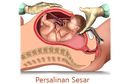 Masih Takut Operasi Sesar? Berikut 14 Tips Pemulihan Cepat dan Lancar, Terbukti!