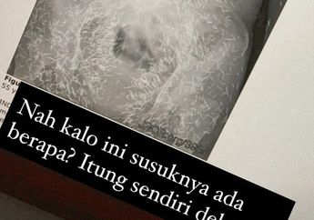 Heboh Foto X-Ray Dipenuhi Susuk, Dukun Kondang Ini Bongkar Kesaktian Susuk Bagi Pemakainya, Sebut Artis Hingga Olahragawan Biasa Pakai Jasanya