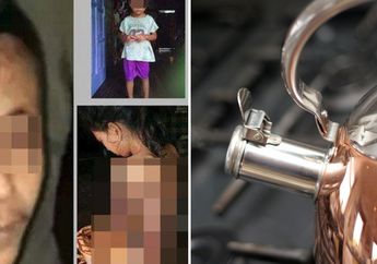 Cuma Gara-gara Sayur yang Dihidangkan untuknya Dikerubuti Semut, Seorang Suami di Garut Tega Siramkan Air Mendidih ke Punggung Istrinya hingga Melepuh