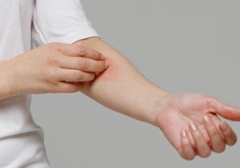 Cara Menghilangkan Bisul dengan Bahan-Bahan Alami, Coba di Rumah