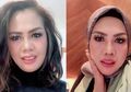 Sukses Bikin Pangling! Elly Sugigi Pamer Senyuman Manis dengan Gigi Rata, 'Mirip Syahrini..."