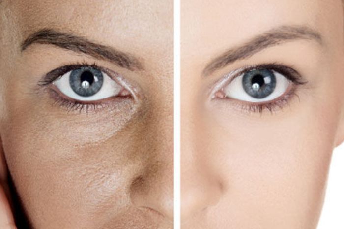 Lelah Sembunyikan Pori Pori Wajah In Cara Alami Dan Permanen Untuk Mengatasinya Dijamin Ampuh Semua Halaman Pop Grid Id