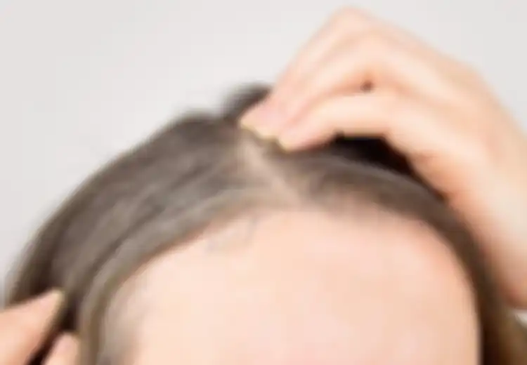 Ingin Rambut Uban Hilang Tak Bersisa? Cukup Parut Jahe dan Oleskan ke Kepala yang Beruban Selama 10 Menit dan Lihat Hasilnya 