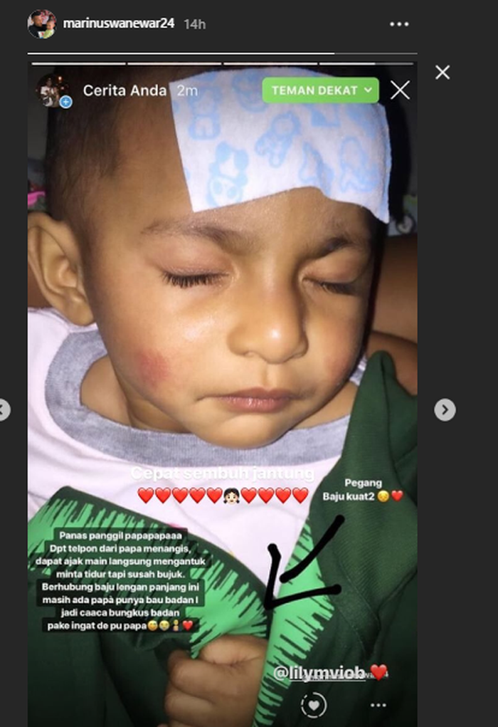 Unggahan Marinus Wanewar perihal kondisi putrinya yang merepost dari Instagram sang istri