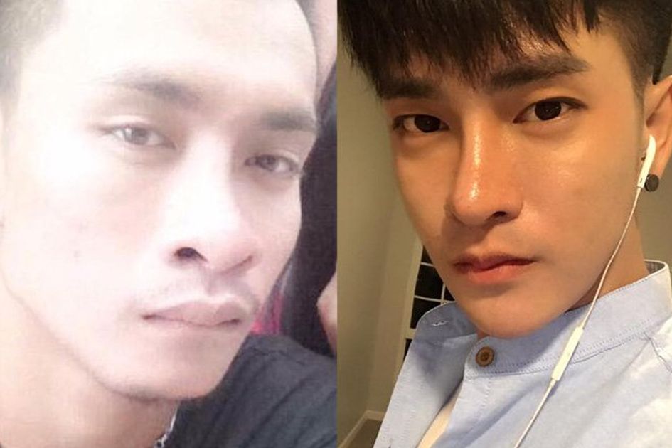 Ingin Mirip Bintang K Pop Seorang Pria Asal Thailand Habiskan Biaya Rp 132 Juta Untuk Melakukan 30 Kali Operasi Plastik
