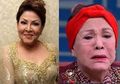 Awalnya Ingin Permak Wajah, Artis Senior Ini Malah Harus Lakukan 21 Operasi Angkat Silikon: Itu Bukan Operasi Bikin Cantik