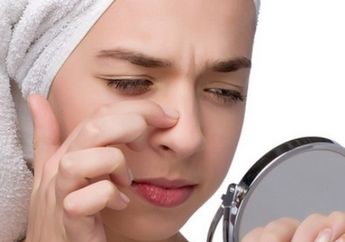 Skincare Anti Komedo Wajib Ada 4 Kandungan Ini, Sudah Tahu Bestie?