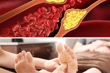 Kenali berikut ini beberapa titik pijat kolesterol sebagai cara untuk menurunkan kadarnya, sebelum minum obat.