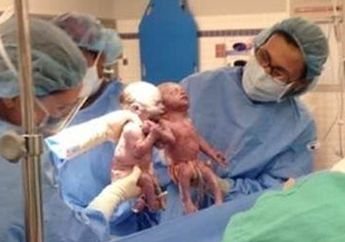 Aiih Lucunya Bayi Kembar Baru Lahir Ini, Keluar Dari Rahim Ibunya Sambil Bergandengan Tangan, Dokter Sampai Kaget