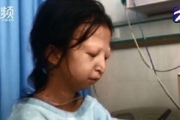 Wu Huayan, gadis 24 tahun yang meninggal dalam kondisi kurang gizi karena hanya makan nasi dan sambal saja.