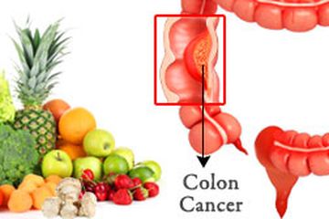 Inilah 10 Bahan Alami yang Berkhasiat Cegah Kanker Usus Besar, Salah Satunya Minyak Kelapa