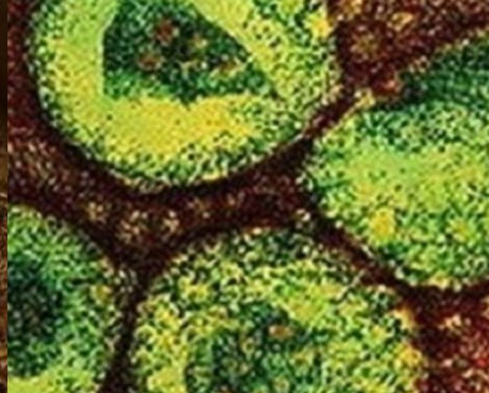 Virus