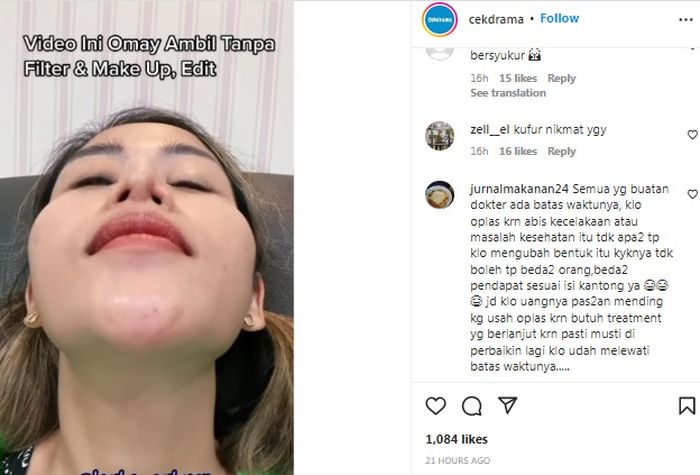 Farida Nurhan tunjukkan kondisi terkini hidungnya