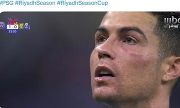 Pipi kiri Cristiano Ronaldo lebam usai terkena tinju Keylor Navas.