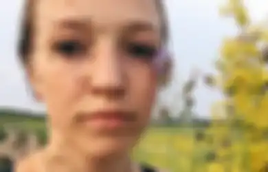 Bikin Aksi 'Jangan Lupa Beri Makan Nyamuk', Wanita Siberia Ini pun Mengguncang Instagram