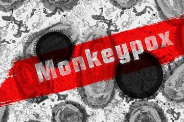 Virus cacar monyet (monkeypox) tidak bertahan lama di udara.