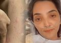 Dilanda Dilema, Ashanty Diminta Cabut KB Spiral Karena Hormonnya Bermasalah, Istri Anang Hermansyah: Enggak Pengin Punya Anak Lagi