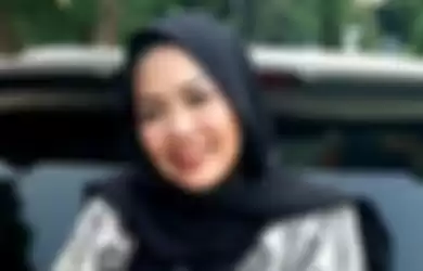 Tampil Beda Usai Tanam Benang Dan Potong Gigi, Elly Sugigi Pamer Lepas Jilbab Demi Cari Uang.