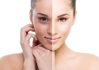 Tanpa Skincare, Lakukan 5 Kebiasaan Ini Biar Wajah Kusam Jadi Glow Up!