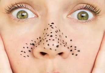 Komedo Hitam Bikin Hidung Terasa Kasar, 2 Masker Alami Ini Andelan Banget Deh