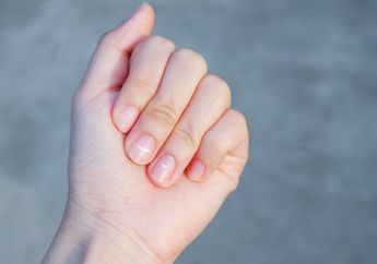 Hati-hati, Punya Bercak Putih di Kuku Ternyata Bisa Jadi Pertanda Penyakit Serius