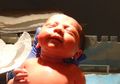 15% Bayi Dilahirkan Prematur di Indonesia, Risiko ROP pun Tinggi yang Bisa Membuat Penderitanya Buta