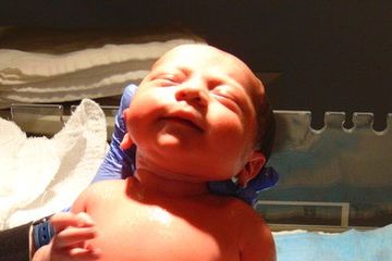 15% Bayi Dilahirkan Prematur di Indonesia, Risiko ROP pun Tinggi yang Bisa Membuat Penderitanya Buta 