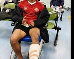 Patah Kaki dan Geser Ligamen, Bagus Kahfi Naik Meja Operasi Besok