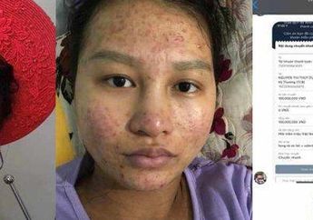 Dijamin Bikin Baper! Minta Cerai Karena Muka Jelek Usai Lahiran, Tak Disangka Respon Suami Bikin Istri Tersentuh Malah Ditransfer Rp379 Juta Untuk Perawatan
