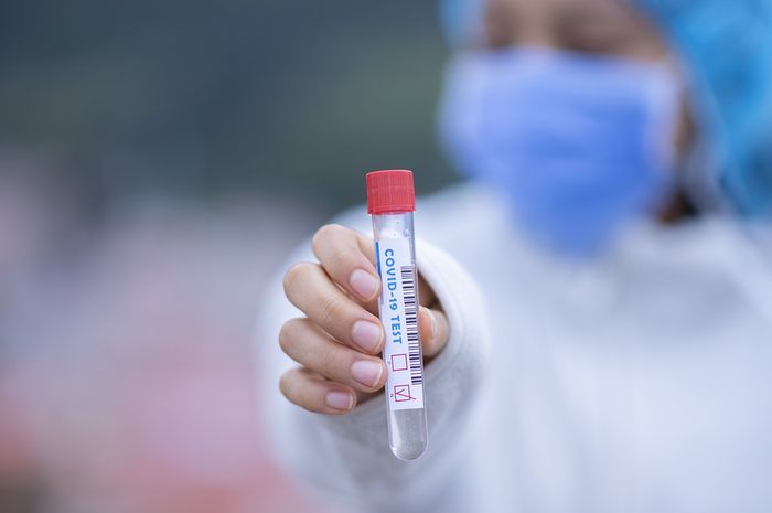 Arti Hasil Rapid Test Reaktif, Apakah Berarti Positif Covid-19? - Kids