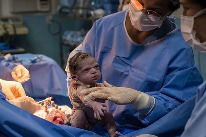 Viral, Bayi Berwajah 'Marah', Sama Sekali Tak Menangis ...