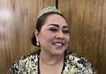 Alasan Nunung Sabu Dapat Jaga Stamina, Studi Bilang Sel Dopamin dalam Otak Hancur hingga Bisa Dorong Bunuh Diri
